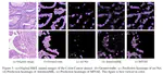 Non-I.I.D. Multi-Instance Learning for Predicting Instance and Bag Labels using Variational Auto-Encoder